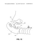 CPAP INTERFACE AND BACKUP DEVICES diagram and image