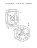 Fluid retention package system diagram and image