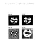 METHOD AND APPARATUS FOR DYNAMIC DISTORTION CORRECTION IN EPI MEASUREMENTS IN MEDICAL MAGNETIC RESONANCE IMAGING diagram and image