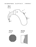 Hearing aid with acoustic damper diagram and image
