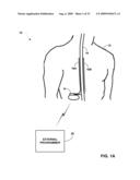 ELECTRODE-TO-LEAD ASSOCIATION USING POST-IMPLANT IMAGING diagram and image