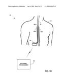 ELECTRODE-TO-LEAD ASSOCIATION USING POST-IMPLANT IMAGING diagram and image