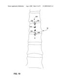 ELECTRODE-TO-LEAD ASSOCIATION USING POST-IMPLANT IMAGING diagram and image