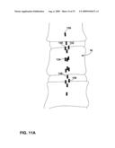 ELECTRODE-TO-LEAD ASSOCIATION USING POST-IMPLANT IMAGING diagram and image