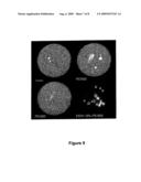 Composition for increasing microorganism wall permeability and method for detecting said microorganisms on a membrane diagram and image