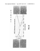 Therapeutic ophthalmic compositions containing retinal friendly excipients and related methods diagram and image