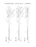 Endoscope treatment instrument diagram and image