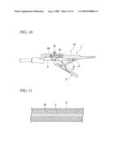 Endoscope treatment instrument diagram and image