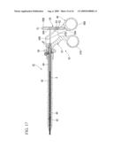 Endoscope treatment instrument diagram and image