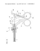 Endoscope treatment instrument diagram and image