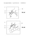 WORKFLOW TO ENHANCE A TRANSJUGULAR INTRAHEPATIC PORTOSYSTEMIC SHUNT PROCEDURE diagram and image