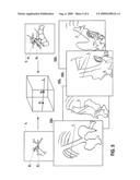 WORKFLOW TO ENHANCE A TRANSJUGULAR INTRAHEPATIC PORTOSYSTEMIC SHUNT PROCEDURE diagram and image