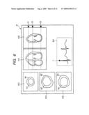 ULTRASONOGRAPH, MEDICAL IMAGE PROCESSING DEVICE, AND MEDICAL IMAGE PROCESSING PROGRAM diagram and image