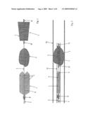 Device for the Removal of Thrombi From Blood Vessels diagram and image