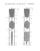 Device for the Removal of Thrombi From Blood Vessels diagram and image