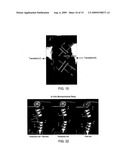 Pedicle Screw diagram and image