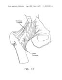 METHOD AND APPARATUS FOR RE-ATTACHING THE LABRUM OF A HIP JOINT diagram and image