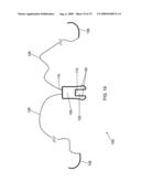 METHOD AND APPARATUS FOR RE-ATTACHING THE LABRUM OF A HIP JOINT diagram and image