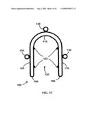 BONE TISSUE FIXATION DEVICE AND METHOD diagram and image