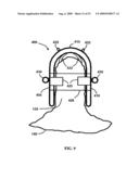 BONE TISSUE FIXATION DEVICE AND METHOD diagram and image