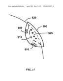 BONE TISSUE FIXATION DEVICE AND METHOD diagram and image