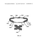 BONE TISSUE FIXATION DEVICE AND METHOD diagram and image