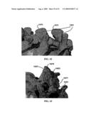 BONE TISSUE FIXATION DEVICE AND METHOD diagram and image