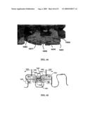 BONE TISSUE FIXATION DEVICE AND METHOD diagram and image