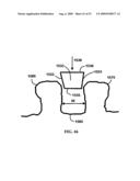 BONE TISSUE FIXATION DEVICE AND METHOD diagram and image