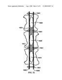 BONE TISSUE FIXATION DEVICE AND METHOD diagram and image