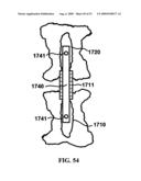 BONE TISSUE FIXATION DEVICE AND METHOD diagram and image