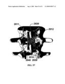 BONE TISSUE FIXATION DEVICE AND METHOD diagram and image