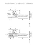 Spinal Rod Link Reducer diagram and image