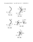 Spinal Rod Link Reducer diagram and image