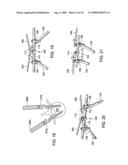 Spinal Rod Link Reducer diagram and image