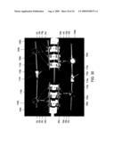 Spinal Rod Link Reducer diagram and image