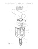 Assembly for Orthopaedic Surgery diagram and image