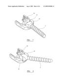 Assembly for Orthopaedic Surgery diagram and image