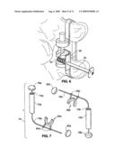 SPINAL IMPLANT AND METHOD FOR RESTRICTING SPINAL FLEXION diagram and image