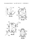 SPINAL IMPLANT AND METHOD FOR RESTRICTING SPINAL FLEXION diagram and image