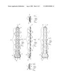 SUBCONDYLAR FRACTURE FIXATION PLATE SYSTEM FOR TUBULAR BONES OF THE HAND diagram and image