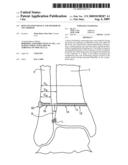 BONE FIXATION DEVICE AND METHOD OF USE THEREOF diagram and image