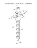 Non-Clamping Fastening Mechanism With Anti-Splay Feature diagram and image