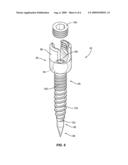 BONE SCREW diagram and image