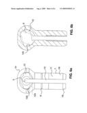 Wire fixation device diagram and image