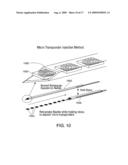 Microtransponder Array for Implant diagram and image