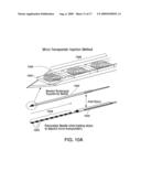 Microtransponder Array for Implant diagram and image