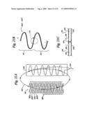 BAROREFLEX ACTIVATION FOR ARRHYTHMIA TREATMENT diagram and image