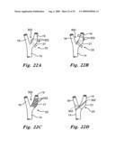 BAROREFLEX ACTIVATION FOR ARRHYTHMIA TREATMENT diagram and image