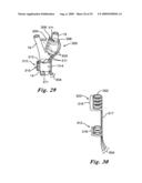 BAROREFLEX ACTIVATION FOR ARRHYTHMIA TREATMENT diagram and image